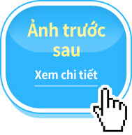 Ảnh trước sau
