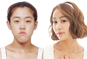 Ảnh trước phẫu thuật
